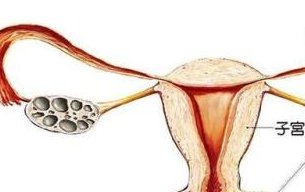 卵巢功能衰退想做三代试管婴儿可以吗？