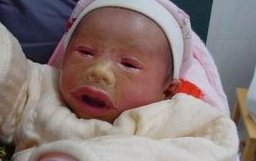 多囊卵巢妈妈必看，试管婴儿成功秘诀，促排卵细节全攻略