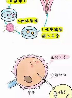 十几万的第三代试管婴儿技术贵在哪里？